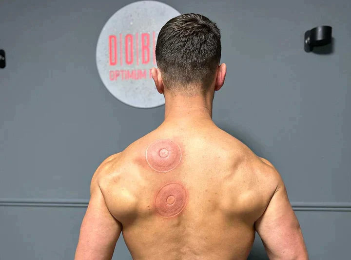 SmartCup Electric Dynamic Cupping Massager, photo 5 of 5