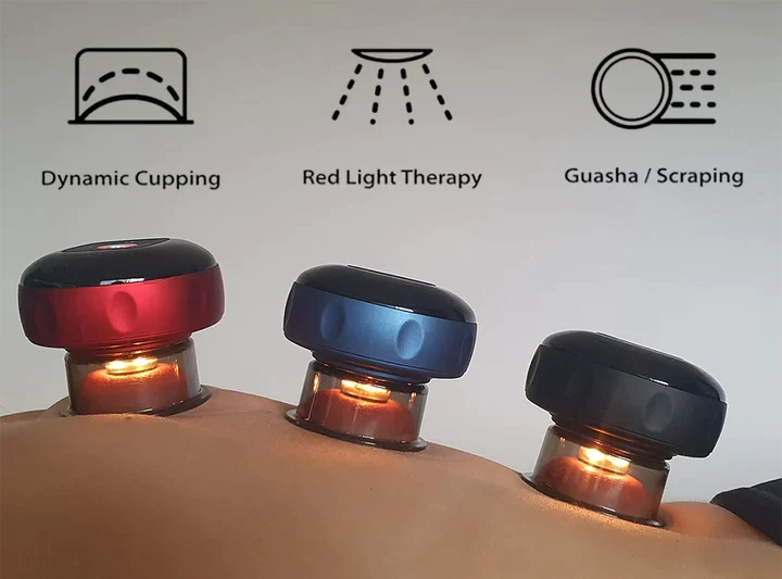 SmartCup Electric Dynamic Cupping Massager, photo 2 of 5