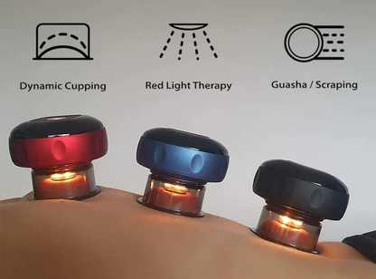 SmartCup Electric Dynamic Cupping Massager, photo 2 of 5